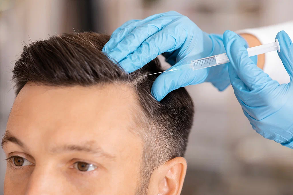 Hair transplant or PRP therapy for natural hair growth