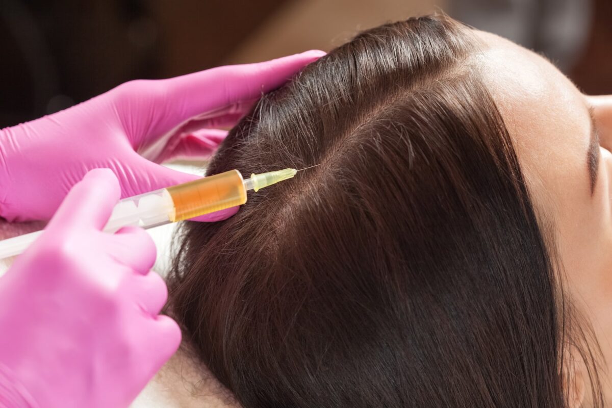 Hair transplant procedure showing natural hair regrowth and restored hairline