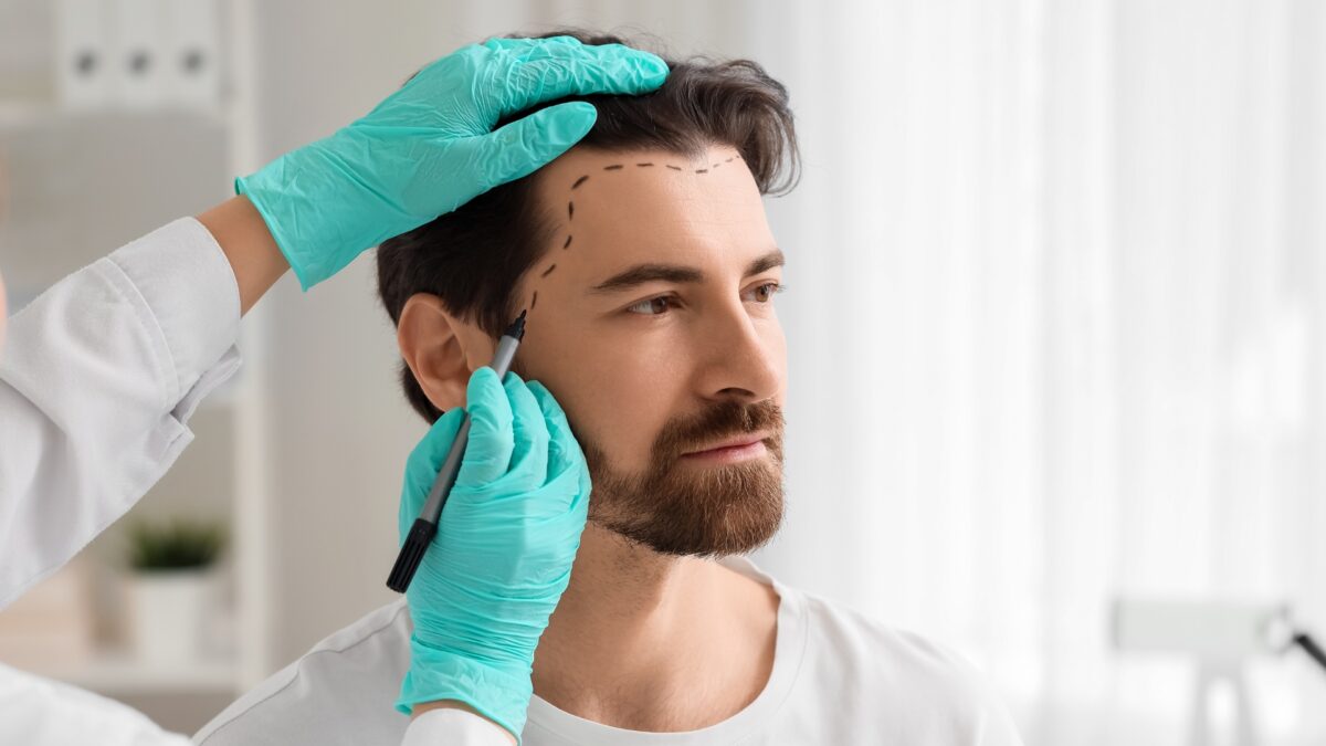 Hair restoration consultation showing important pre-surgery information