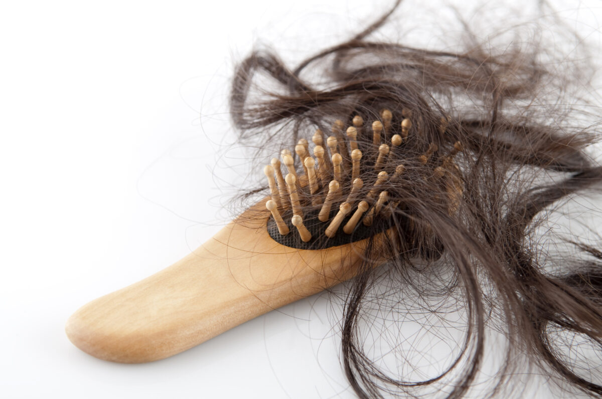 Professional hair evaluation for assessing hair loss patterns and planning hair restoration treatment.