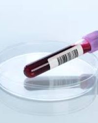 Best Tests for Hair loss Treatment in Lahore